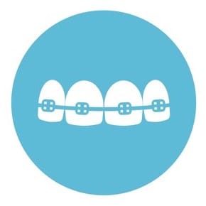 braces